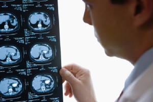 California Spine Diagnostics